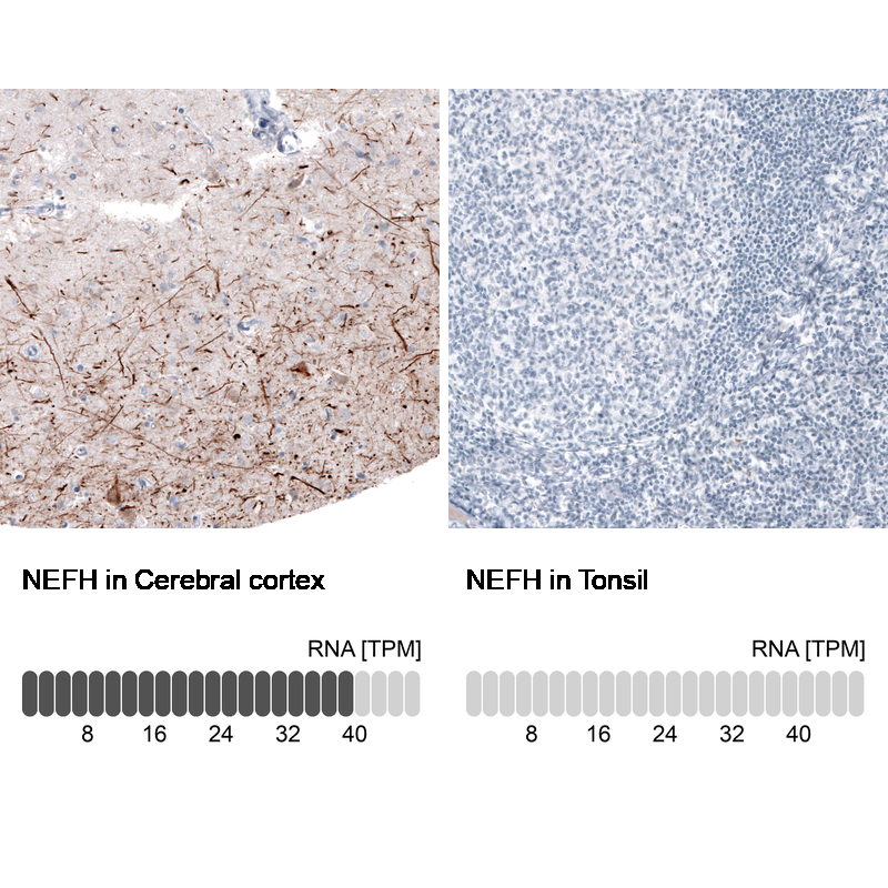 Atlas Antibodies Anti-NEFH Antibody