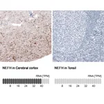 Atlas Antibodies Anti-NEFH Antibody
