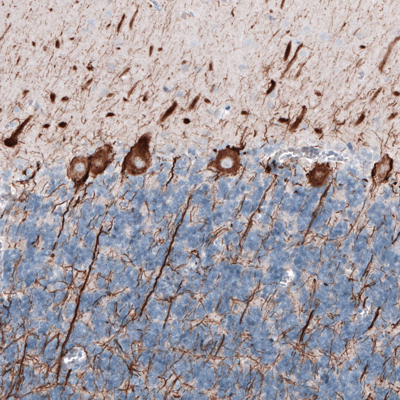 Atlas Antibodies Anti-NEFL Antibody