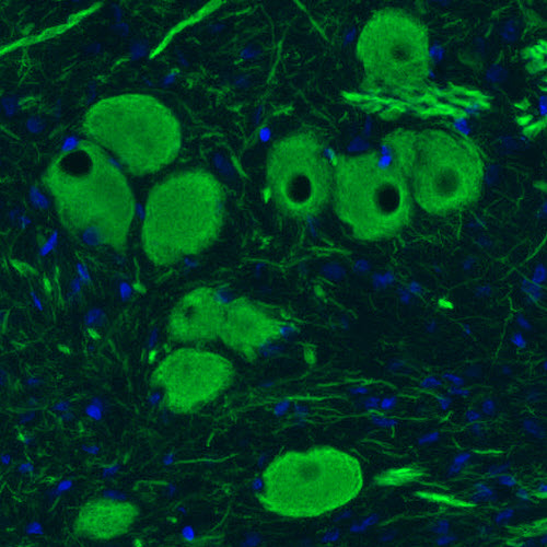 Atlas Antibodies Anti-NEFM Antibody