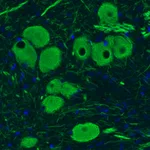 Atlas Antibodies Anti-NEFM Antibody