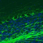 Atlas Antibodies Anti-NEFM Antibody