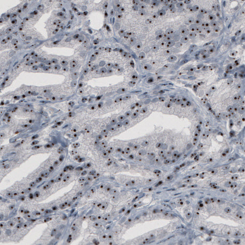 Atlas Antibodies Anti-NOP56 Antibody