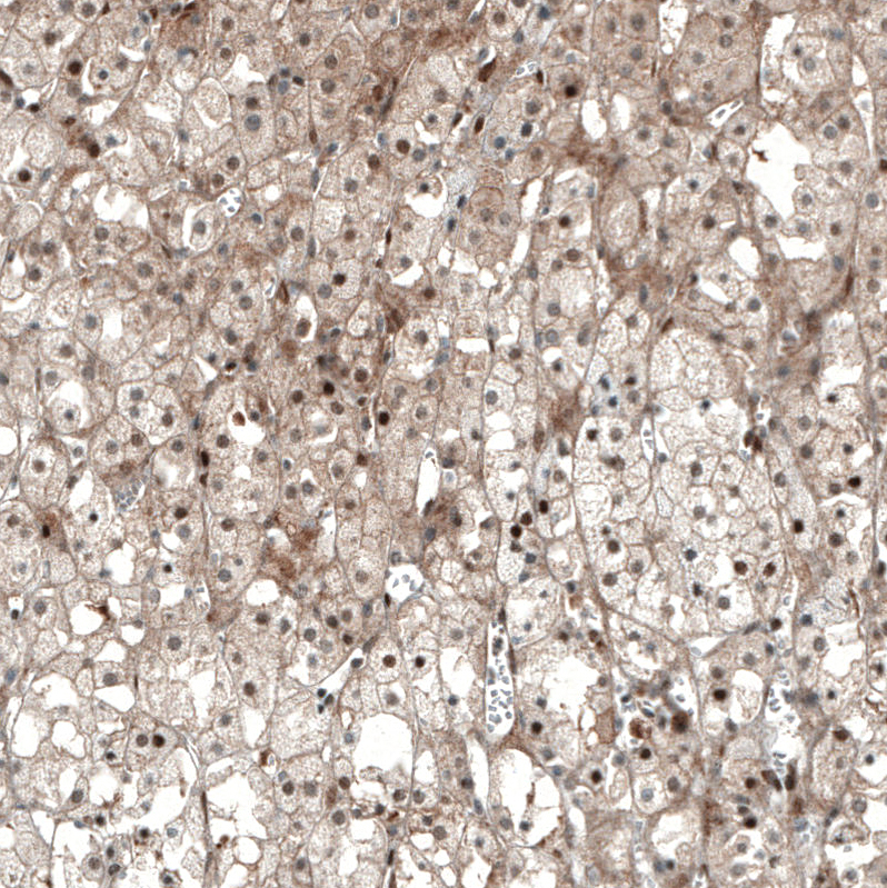 Atlas Antibodies Anti-NR5A1 Antibody