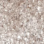 Atlas Antibodies Anti-NR5A1 Antibody