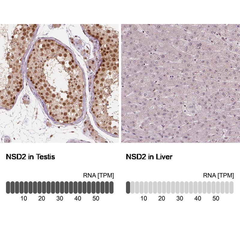 Atlas Antibodies Anti-NSD2 Antibody