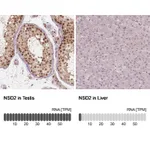 Atlas Antibodies Anti-NSD2 Antibody