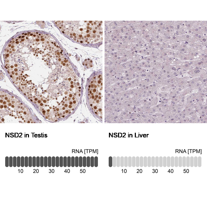 Atlas Antibodies Anti-NSD2 Antibody