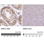 Atlas Antibodies Anti-NSD2 Antibody