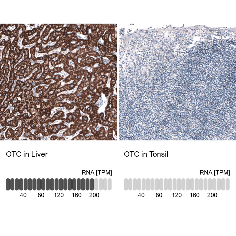 Atlas Antibodies Anti-OTC Antibody