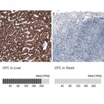 Atlas Antibodies Anti-OTC Antibody