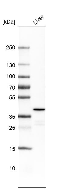 Atlas Antibodies Anti-OTC Antibody