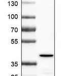 Atlas Antibodies Anti-OTC Antibody