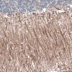 Atlas Antibodies Anti-P2RX7 Antibody