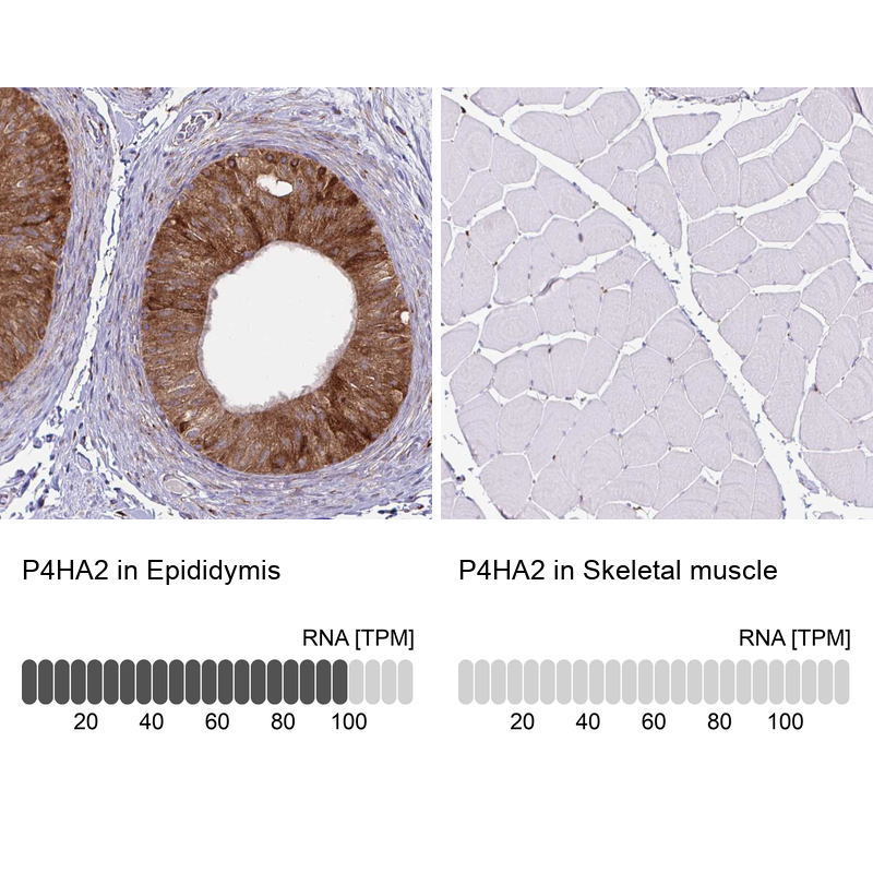 Atlas Antibodies Anti-P4HA2 Antibody