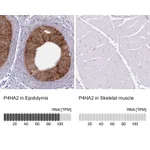 Atlas Antibodies Anti-P4HA2 Antibody