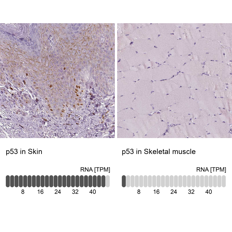 Atlas Antibodies Anti-p53 Antibody