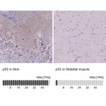 Atlas Antibodies Anti-p53 Antibody