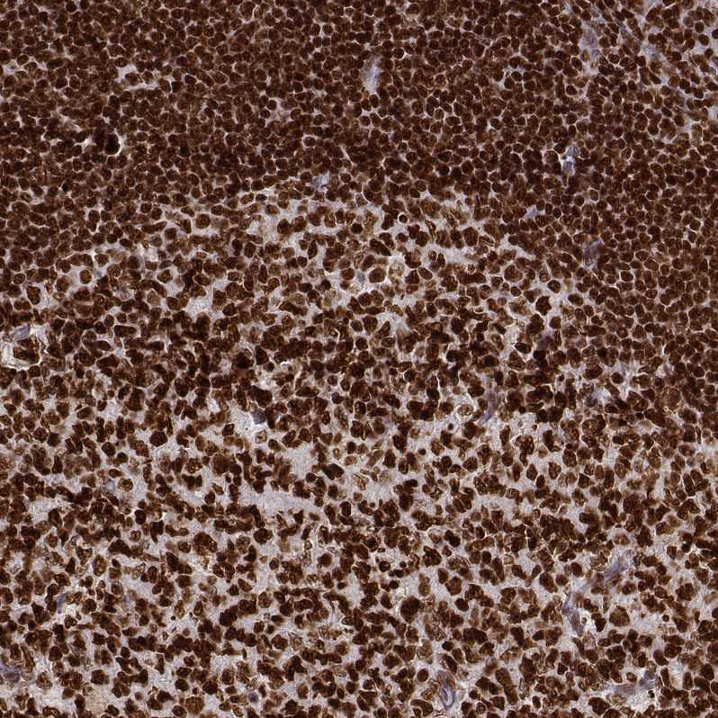 Atlas Antibodies Anti-PARP1 Antibody