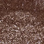 Atlas Antibodies Anti-PARP1 Antibody