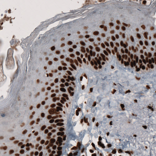 Atlas Antibodies Anti-PARP1 Antibody