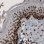 Atlas Antibodies Anti-PARP1 Antibody