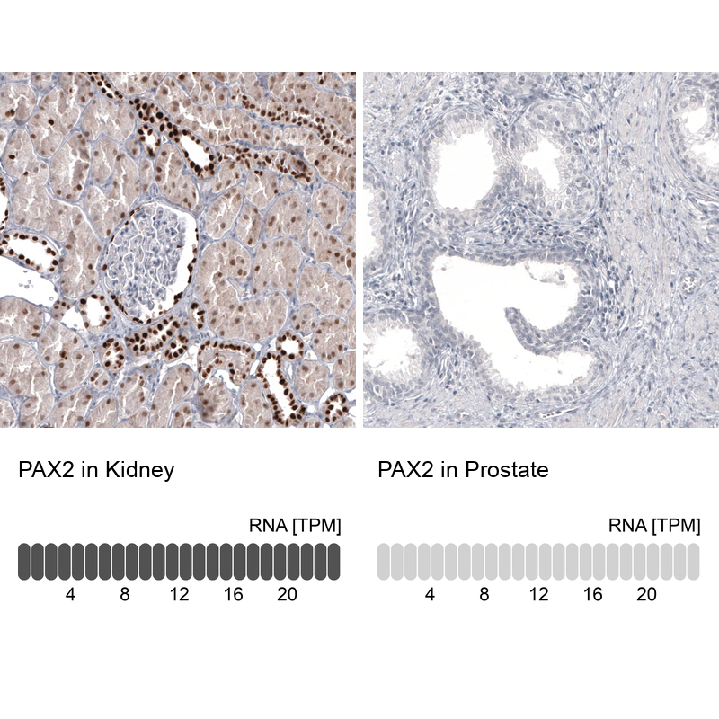 Atlas Antibodies Anti-PAX2 Antibody