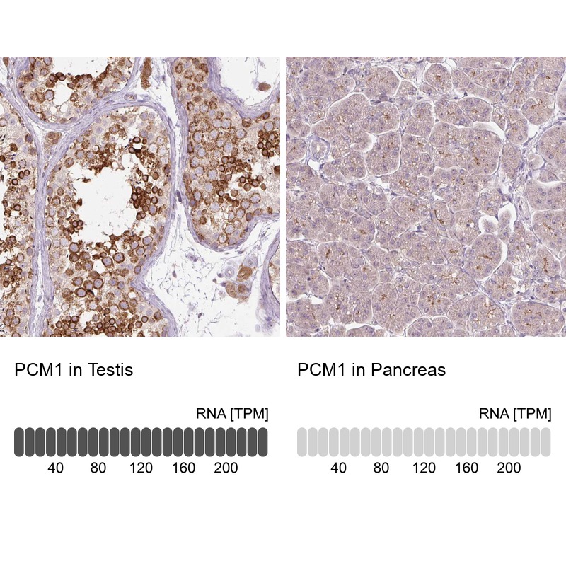 Atlas Antibodies Anti-PCM1 Antibody