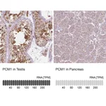 Atlas Antibodies Anti-PCM1 Antibody