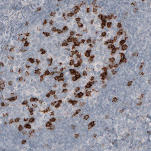 Atlas Antibodies Anti-PDCD1 Antibody
