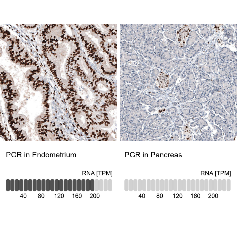 Atlas Antibodies Anti-PGR Antibody