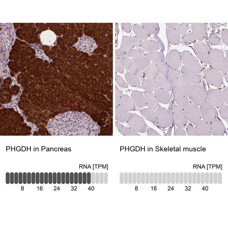 Atlas Antibodies Anti-PHGDH Antibody