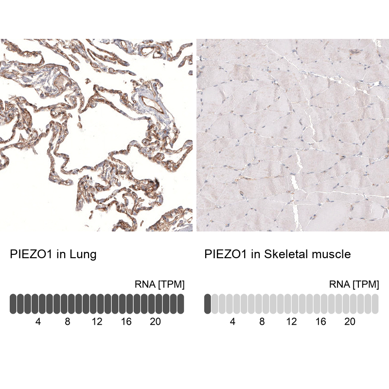 Atlas Antibodies Anti-PIEZO1 Antibody