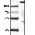 Atlas Antibodies Anti-PIK3CA Antibody