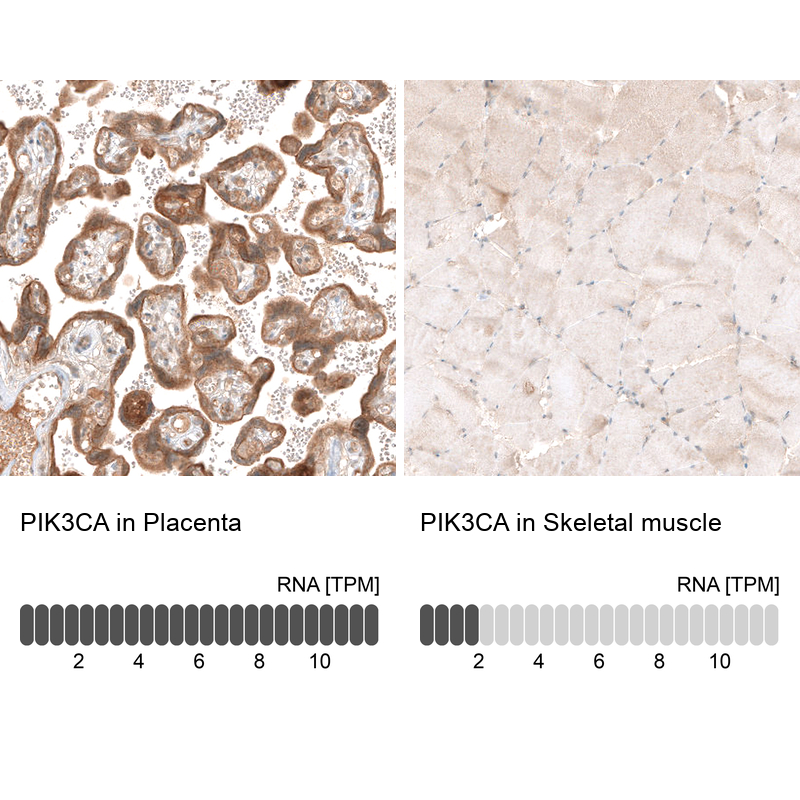 Atlas Antibodies Anti-PIK3CA Antibody