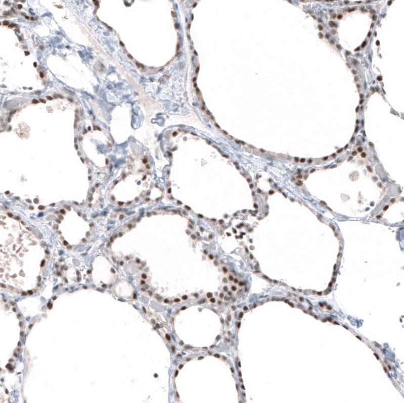 Atlas Antibodies Anti-PIK3CB Antibody