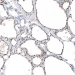 Atlas Antibodies Anti-PIK3CB Antibody