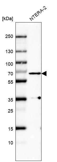 Atlas Antibodies Anti-PLK1 Antibody