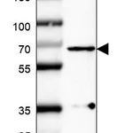 Atlas Antibodies Anti-PLK1 Antibody