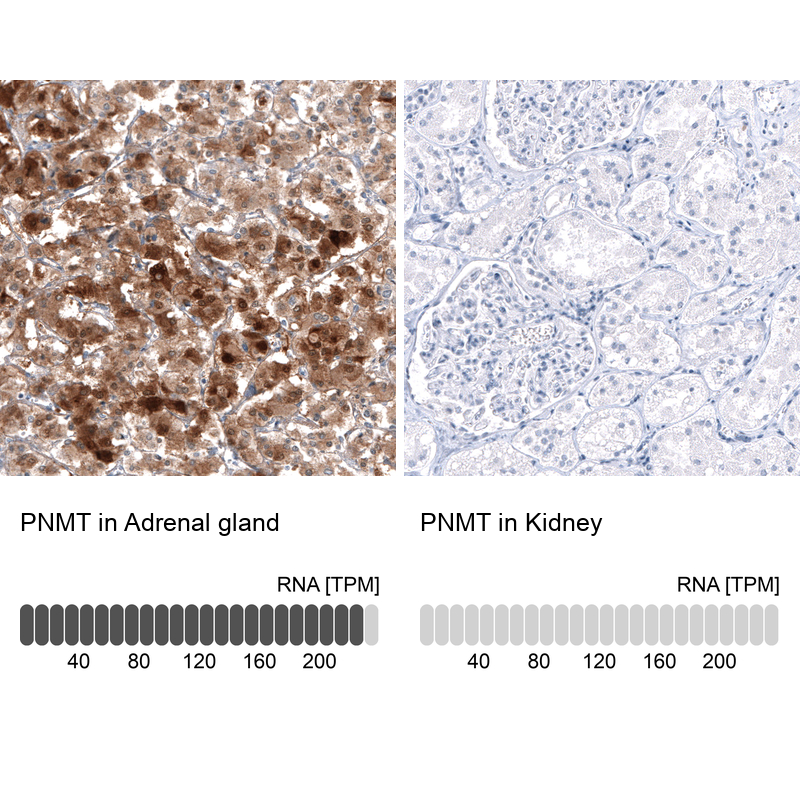 Atlas Antibodies Anti-PNMT Antibody