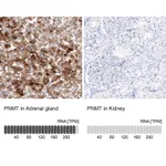 Atlas Antibodies Anti-PNMT Antibody