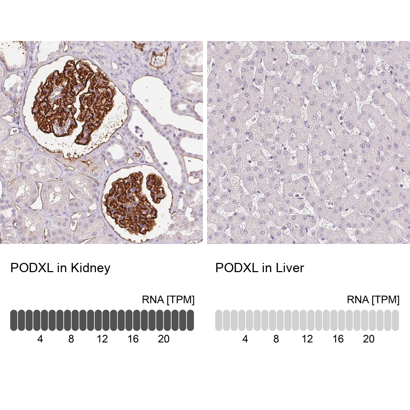 Atlas Antibodies Anti-PODXL Antibody