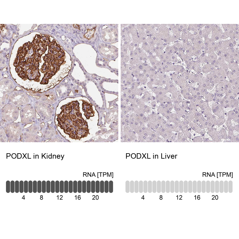 Atlas Antibodies Anti-PODXL Antibody