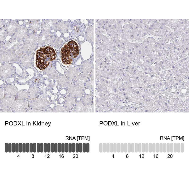 Atlas Antibodies Anti-PODXL Antibody