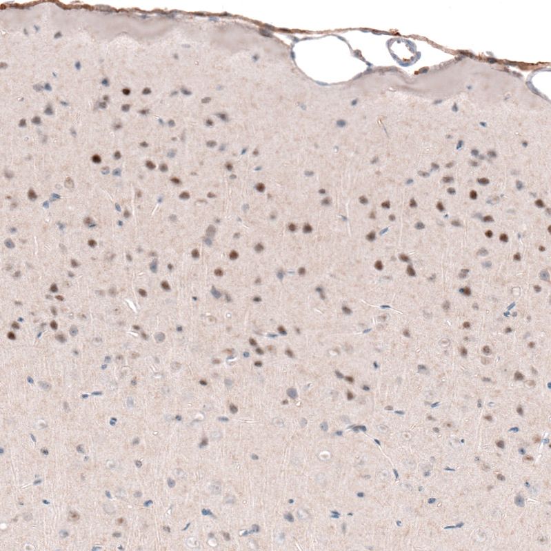 Atlas Antibodies Anti-POU3F2 Antibody