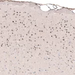 Atlas Antibodies Anti-POU3F2 Antibody