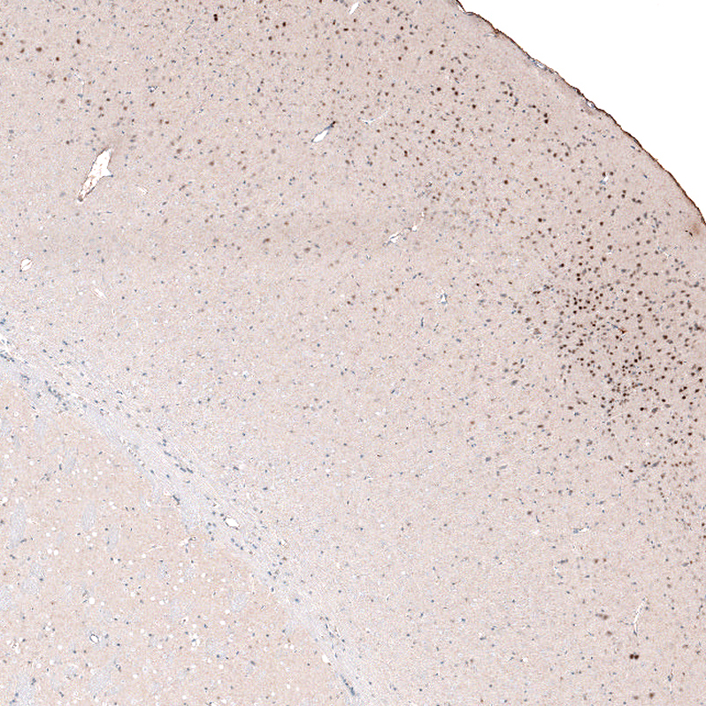 Atlas Antibodies Anti-POU3F2 Antibody