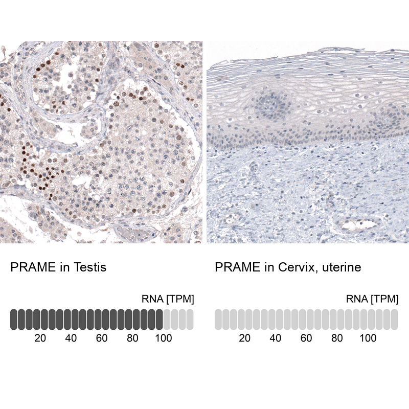 Atlas Antibodies Anti-PRAME Antibody