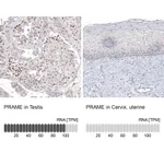 Atlas Antibodies Anti-PRAME Antibody