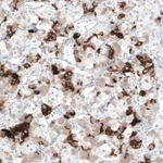 Atlas Antibodies Anti-PRL Antibody